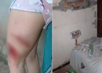 Mulher fica ferida ao ser atingida por raio dentro de casa no Norte do Piauí