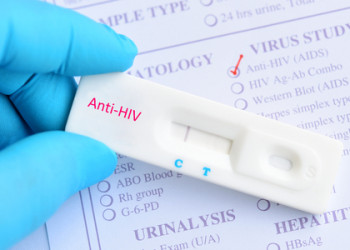 Teresina tem queda de novos casos de HIV depois de seis anos de alta