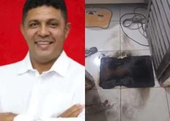 Vereador de Coivaras tem corpo queimado por mulher que invadiu a sua casa