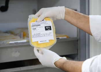 Hemopi recebe equipamentos para ampliar a produção e armazenamento de plasma