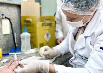 Pesquisa da UFPI oferece testagem gratuita de ISTs e amplia acesso ao diagnóstico precoce