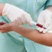 Chega ao Brasil exame de sangue inédito que detecta Alzheimer