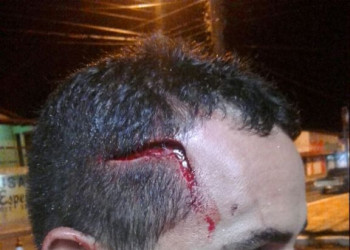Jovem é agredido pelo tio com uma barra de ferro  sofrendo uma lesão na cabeça.