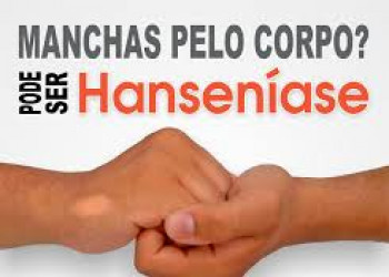 FMS lança Campanha de Hanseníase e examinará 85 mil estudantes em Teresina