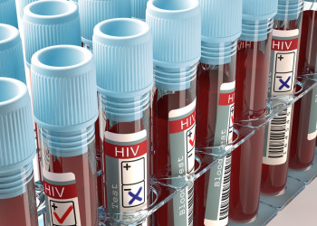 Ministério da Saúde estima que 133 mil brasileiros vivem com HIV e não sabem