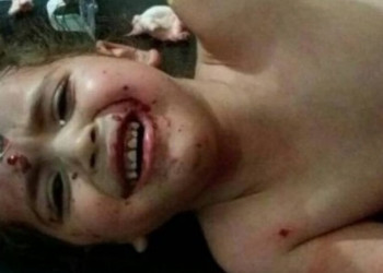 Quatro crianças sírias morrem e 25 ficam feridas em bombardeio a creche