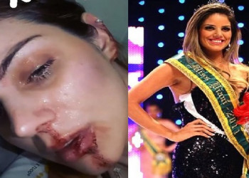 Miss Piauí 2011 registra B.O contra ex-marido que a agrediu