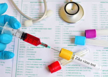 Teste rápido da Fiocruz para diagnosticar zika é aprovado pela Anvisa