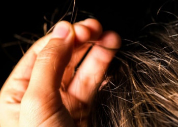 Entenda a séria doença por trás da obsessão em arrancar cabelos