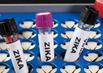 Aborto em caso de zika é 'mais delicado', diz presidente do STF