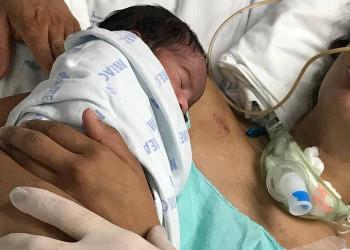 Mãe sai do coma após sentir o filho recém-nascido no colo em Fortaleza