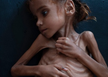 Morre o símbolo da fome causada por guerra no Iêmen