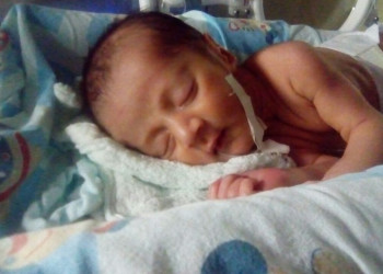 Recém-nascido precisa de doação de plaquetas com urgência
