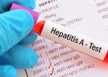 Casos de hepatite A mais que dobram entre homens de 20 a 39 anos