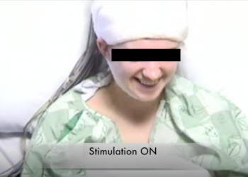 Médicos estimulam cérebros em cirurgias para fazer pacientes rirem