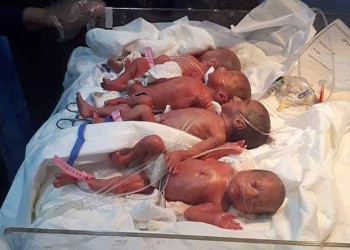 Mulher de 25 anos dá à luz a sete bebês de parto normal