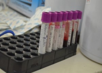 Doação de sangue diminui durante as  férias e Hemopi convoca população