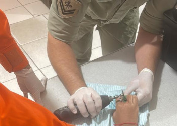 Bombeiros removem anel preso em dedo de menina autista; ela já tinha ido a 3 hospitais