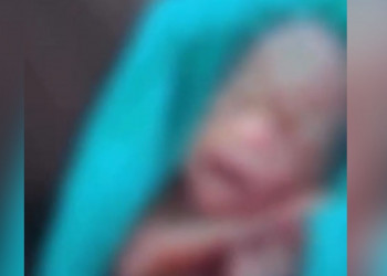 Recém-nascido dado como morto chora no caixão durante o velório no Acre