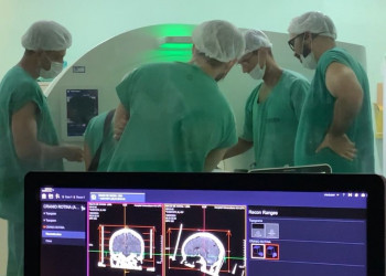 HU-UFPI realiza primeira cirurgia da Doença de Parkinson pelo SUS no Piauí