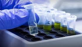 Câmara aprova teste genético para risco de câncer de mama e colo de útero