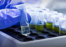 Câmara aprova teste genético para risco de câncer de mama e colo de útero