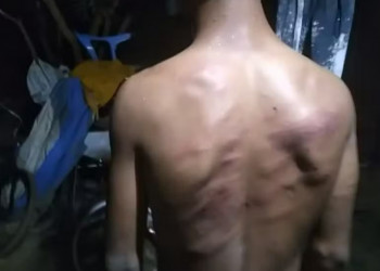 Adolescente diz que foi espancado e torturado por guardas municipais em Teresina