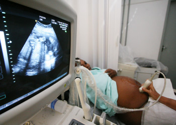 Teste de HLTV passa a ser indicado para grávidas durante o pré-natal
