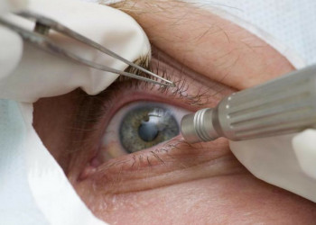 Síndrome do olho seco: especialistas alertam para atenção ao 