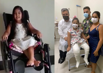 Criança que sonha em caminhar realiza cirurgia para correção do pé torto congênito