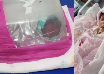 Bebê prematura que viajou 8 horas em incubadora improvisada tem alta da UTI em Teresina