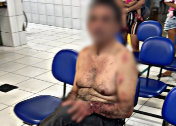 Garçom desfere 20 facadas contra companheira e é preso em flagrante em Teresina