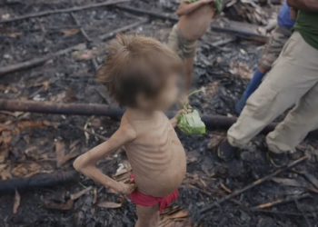 Malária, pneumonia e desnutrição:  tragédia Yanomami permitida por Bolsonaro