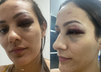 Coren-PI repudia agressão de servidor do TJ contra enfermeira em Teresina