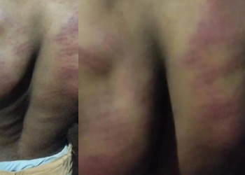 PMs são afastados por suspeita de torturar estudante quilombola no Piauí