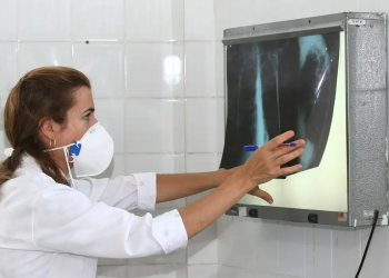 Em cinco meses, Piauí registra 916 novos casos de tuberculose