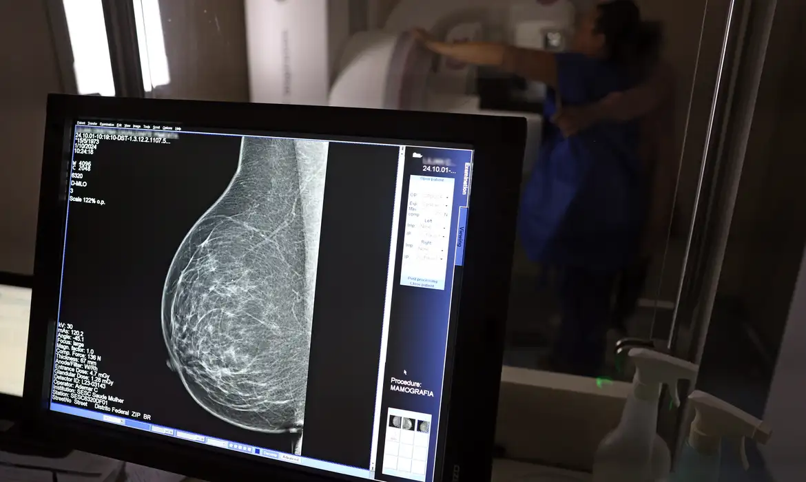 Mamografia para detecção precoce do câncer de mama