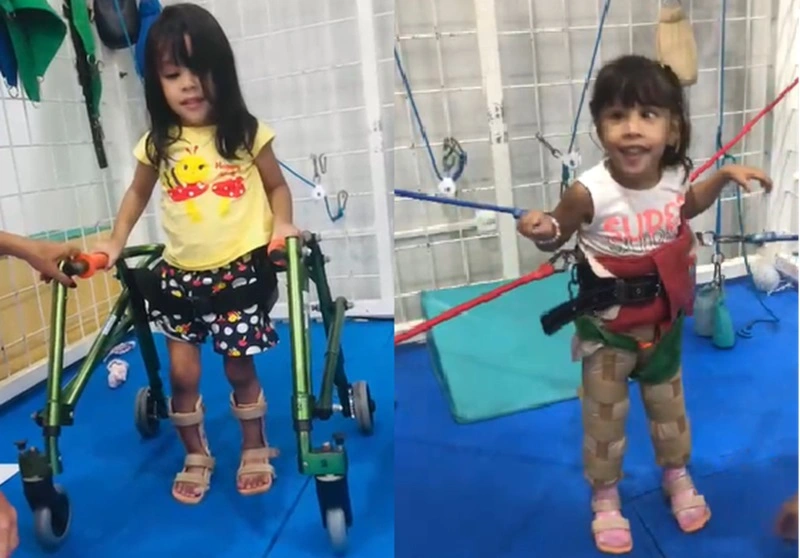 Alice Gabriela tem paralisia cerebral e precisa do tratamento do método Therasuit para se desenvolver