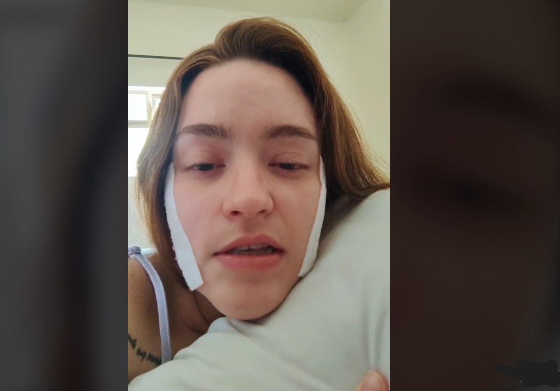 Carolina Arruda Leite, de 27 anos tem neuragia do trigêmio desde os 16 anos