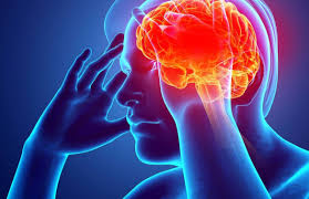 Piauí registra redução de mortes por AVC