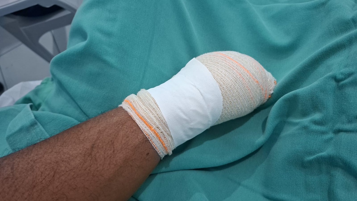 Homem tem mão decepada em briga por terra