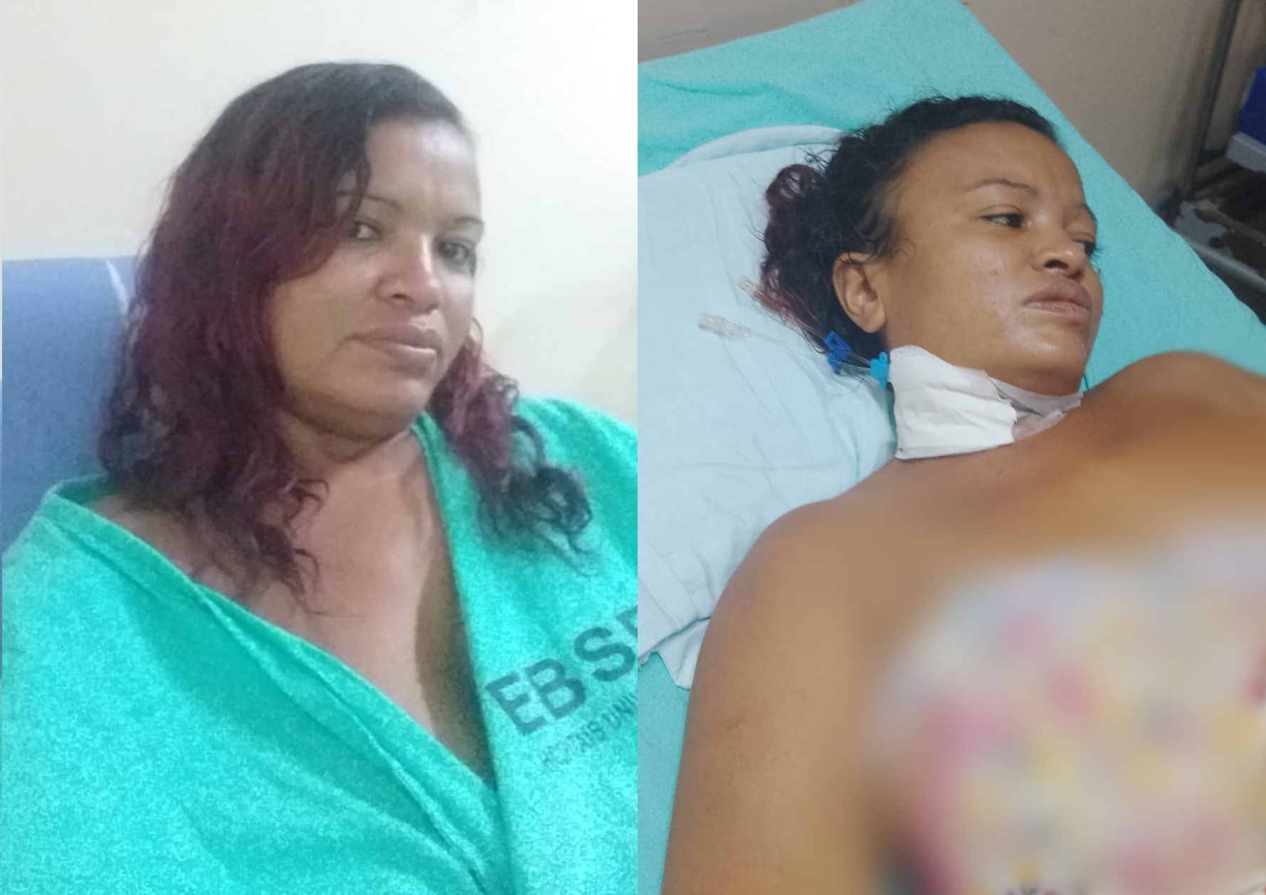 Eliane Basila da Silva está internada há 51 dias desde a cirurgia