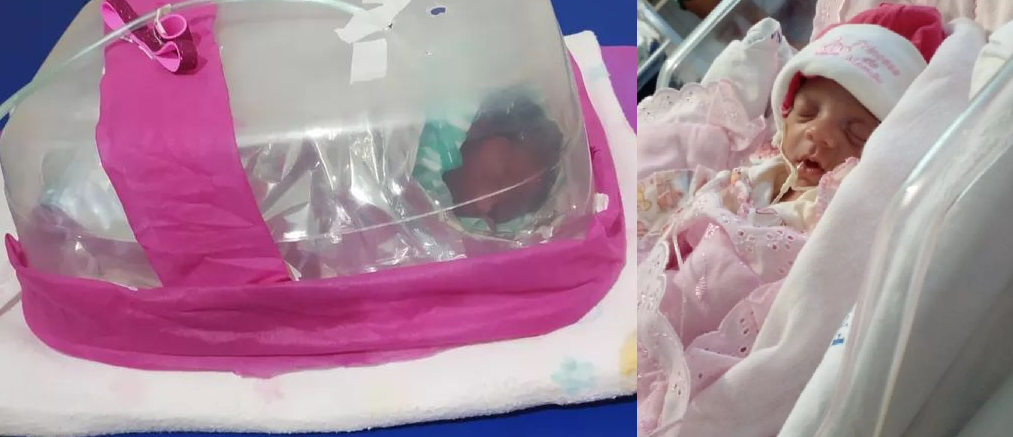 A recém-nascida sobreviveu graças a incubadora improvisada