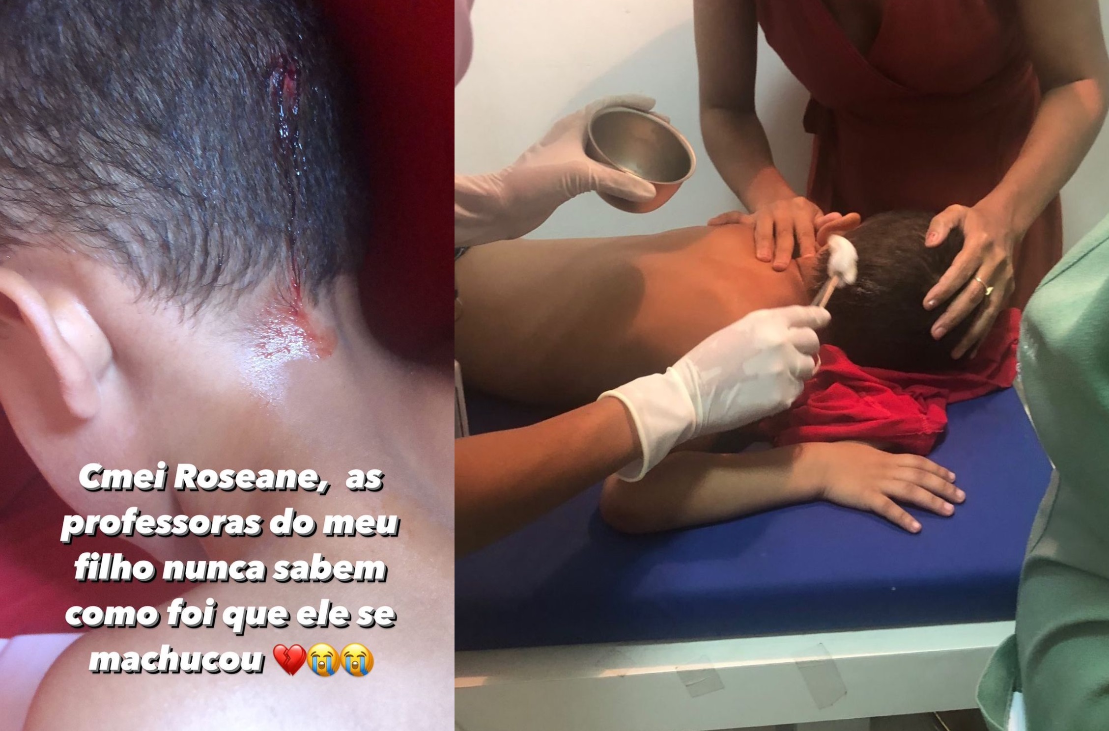 A criança foi levada para um hospital de urgência onde passou por procedimento de sutura