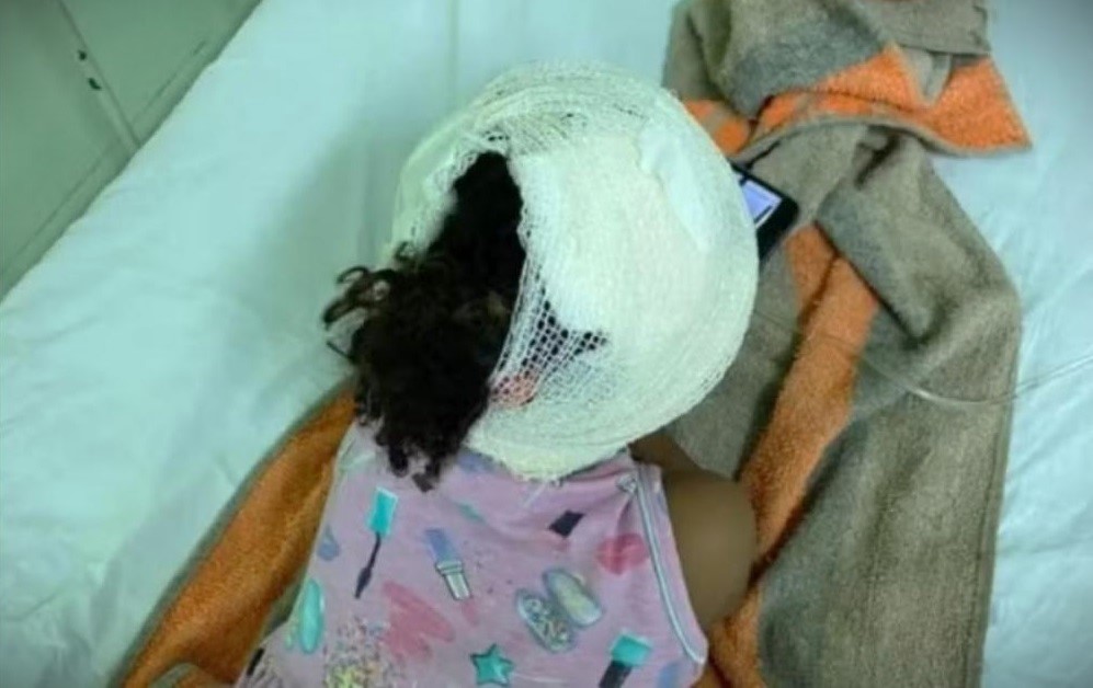 A criança foi internada no Hospital de Urgência de Teresina