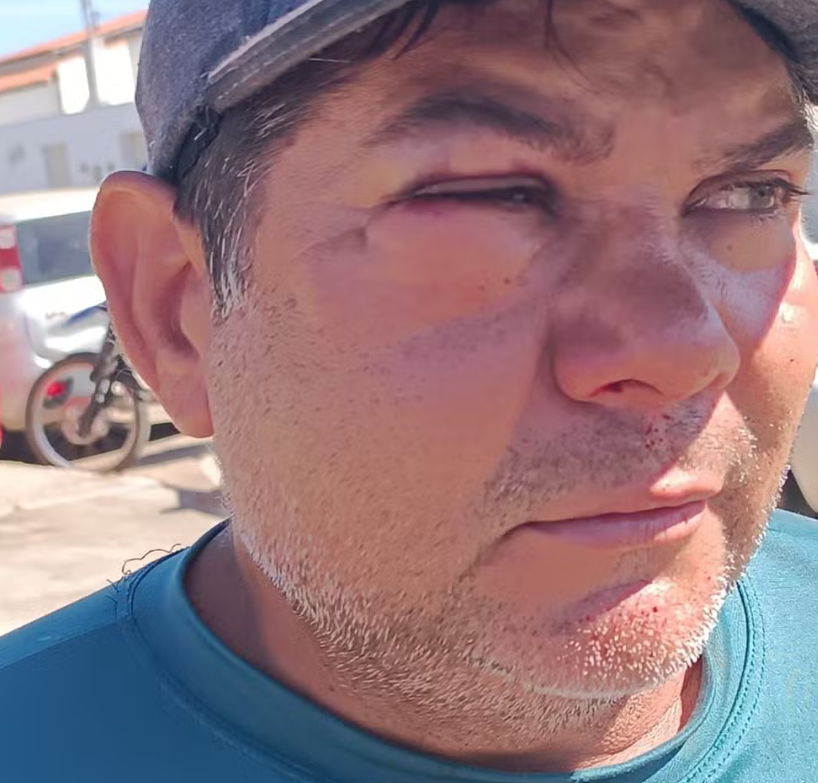 Servidor da Prefeitura de São Raimundo Nonato foi agredido enquanto realizava seu trabalho