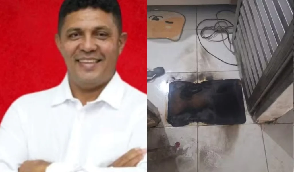 Vereador de Coivaras tem o corpo queimado por mulher que invadiu sua residência