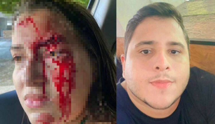 Estudante é agredida por namorado