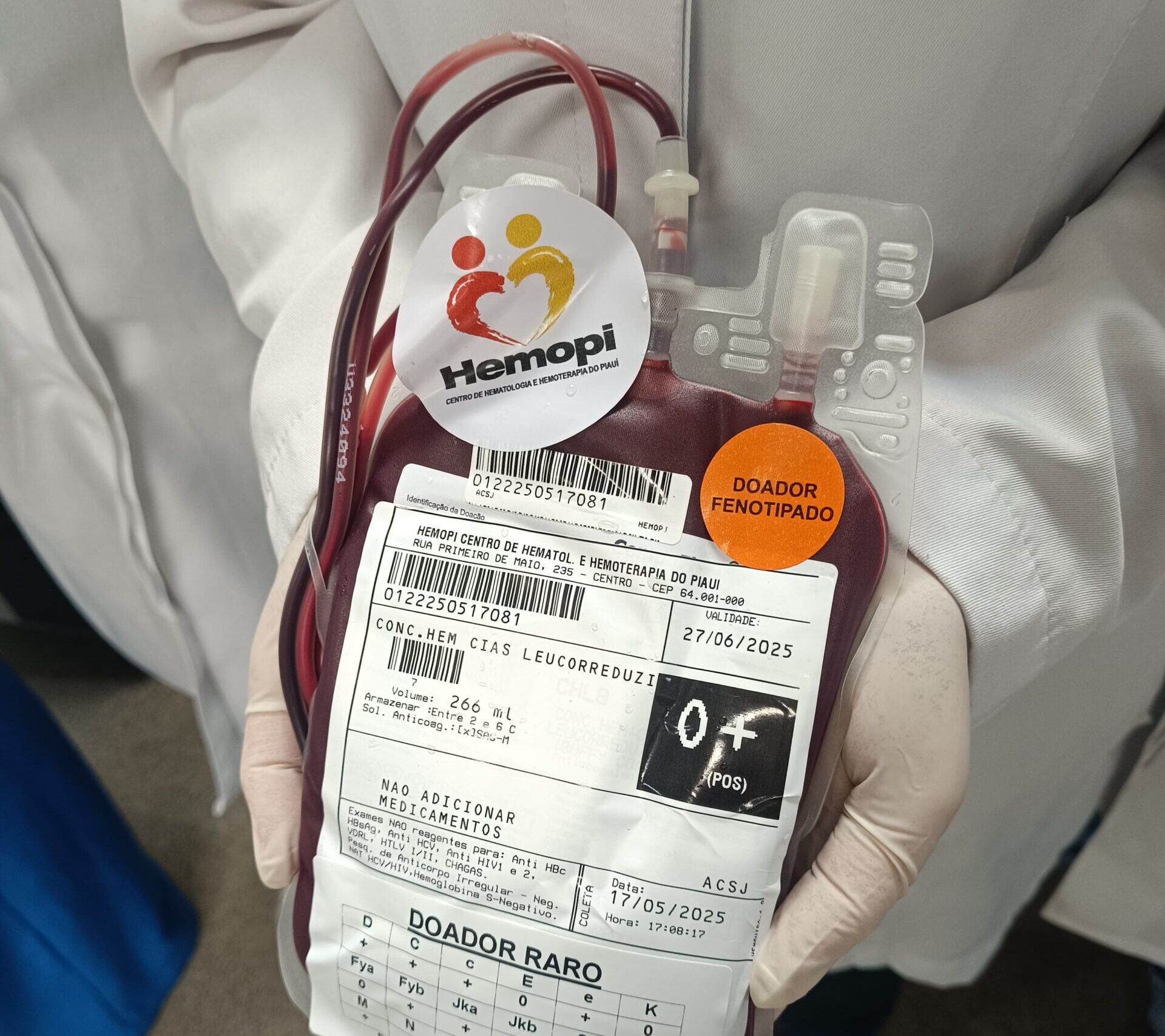 Hemopi identifica sangue raro e garante transfusão segura a paciente do HUT